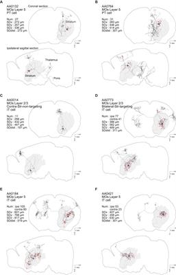 Differential Striatal Axonal Arborizations of the Intratelencephalic and Pyramidal-Tract Neurons: Analysis of the Data in the MouseLight Database